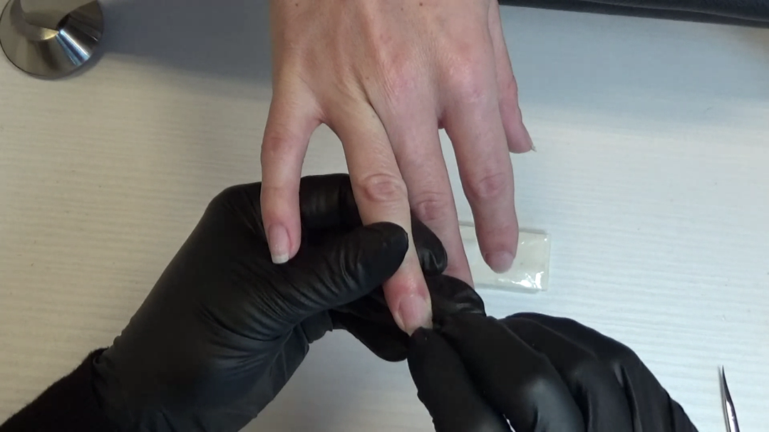 Укрепване на счупен нокът